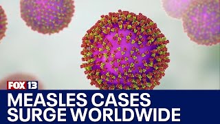 Measles cases surge worldwide  FOX 13 Seattle [upl. by Sibley]