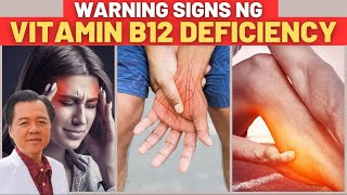 9 Warning Signs na Kulang Ka sa Vitamin B12  By Doc Willie Ong Internist and Cardiologist [upl. by Maitund]