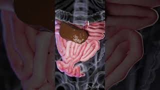 Understanding Small Bowel Perforation anatomy biology 3danimation [upl. by Sanalda]