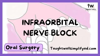 INFRAORBITAL NERVE BLOCK TECHNIQUE  Tips for finding the infraorbital foramen [upl. by Eselahs8]