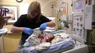 Causes Behind Premature Births [upl. by Etnuad]