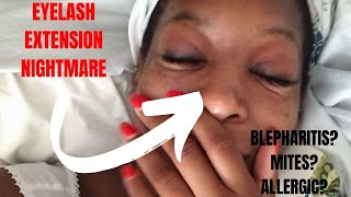 HOW TO TREAT BLEPHARITIS l LASH EXTENSION NIGHTMARE [upl. by Chobot]