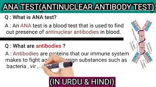 ANA TESTAntinuclear antibody testhow to read result easily explained in urdu amp hindi [upl. by Tedra]