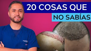 😱🇲🇽🔝INJERTO de CABELLO en MÉXICO  20 Cosas que no SABÍAS [upl. by Zarla825]