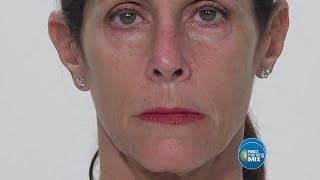 Plexaderm gets rid of age lines and wrinkles [upl. by Getraer]