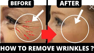 FACE YOGA FOR CROWS FEET  REMOVE WRINKLES [upl. by Ainitsirk]