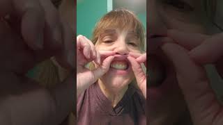 What To Expect When You First Start Wearing Dentures [upl. by Langdon]