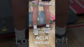 One Exercise That is Critical for Successful ACL Reconstruction Recovery  Pediatric ACL Rehab [upl. by Philomena]