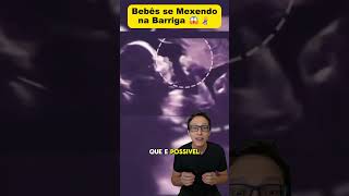 Bebê se Mexendo na Barriga 😱🤰 medicina medico enfermagem enfermeira obstetricia obstetrícia [upl. by Coop]