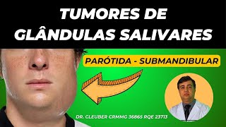 💧 Tumor de Glândula Parótida e Submandibular Desvende o Mistério 💧 [upl. by Yorgerg]