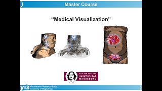 Medical Visualization  Virtual Endoscopy 1 [upl. by Iey]