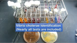 Vibrio cholerae identification  A to Z tests [upl. by Treb]