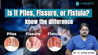 Anorectal disorders Piles Fissures amp Fistula  Causes Symptoms and Treatment  Dr G Uday Kiran [upl. by Trinee]