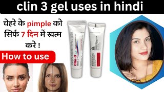 Clin 3 Gel Uses in Hindi  Clindamycin amp Nicotinamide in Aloe Allantoin Gel Base  how To Use [upl. by Hilbert503]