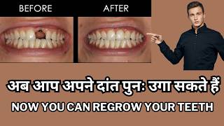 You Can Regrow Teeth Now Worlds First ToothGrowing Drug Explained toothregrowthresolution [upl. by Rianna]