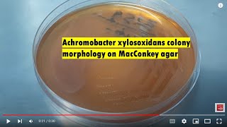 Achromobacter xylosoxidans colony morphology on Macconkey agar [upl. by Saucy262]