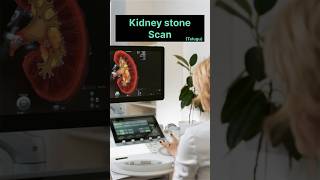 Scan for kidney stones kidneydisease telugufacts [upl. by Leeann579]