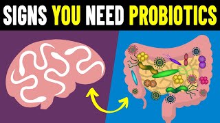 9 Signs You Need To Take Probiotics [upl. by Eycal]