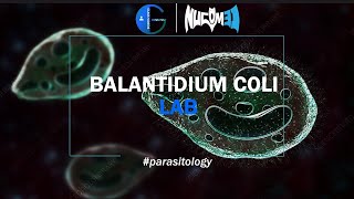 Balantidium coli  DrHuda  LAB 13 [upl. by Ielirol485]