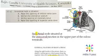 Anatomy Thorax 288 SinoAtrial Node location SinuAtrial Heart SVC Solved Question Paper MCQ [upl. by Mccully287]