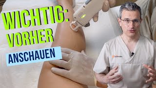 Haarentfernung mit Laser oder IPL Ablauf Erfolge Risiken und Tipps von Dr Robert Kasten Mainz [upl. by Iteerp154]