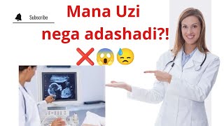 MANA NIMA UCHUN UZI HOMILA JINSINI XATO AYTADI😨😱😱😱❌❌❌❌❌❌❌❌ BUNI BILISHINGIZ SHART🔥💯🆘🆘🆘🆘✅✅✅ [upl. by Tehcac]