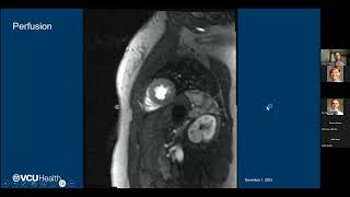 MRI Contrast Agents  Cory Trankle MD [upl. by Anelac]