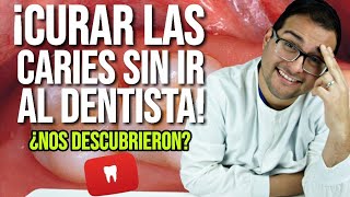 ¿QUITAR las CARIES sin ir al DENTISTA 😲 ELIMINA tus DUDAS  EXPLICACIÓN DEFINITIVA 😎 50 [upl. by Blaze]