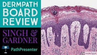 Dermpath Board Review 100 Classic Cases [upl. by Vivianna]