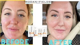 RODAN AND FIELDS  REVERSE BRIGHTENING REGIMEN ROUTINE AND REVIEWHOW TO [upl. by Kwok]