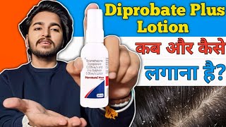 Diprobate Plus Lotion Detailed Review  How to Use Diprobate Plus Lotion [upl. by Oilime]