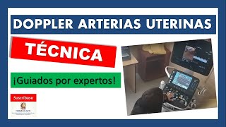 ARTERIA UTERINA DOPPLER ¡Técnica de las 2 arterias DERECHA e IZQUIERDA [upl. by Nicolette433]