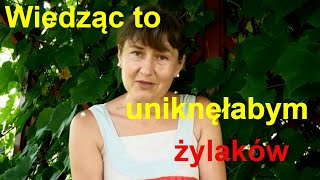 Żylaki Jak Zapobiegać  Żylaki Kończyn Dolnych [upl. by Frances936]