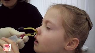 YAMIK procedure  a method for topical treatment of sinusitis [upl. by Claybourne]