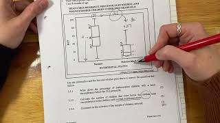 Maths Lit  Paper 1 Nov 2023 Q33  box and whisker plots amp median [upl. by Winton]