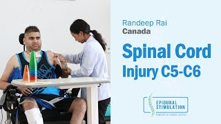 Canadian C5C6 Spinal Cord Injury Patient Randeeps Road to Recovery After Epidural Stimulation [upl. by Htiekal]