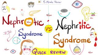 Nephrotic AND Nephritic Syndrome  Quick Review  Nephrology amp Pathology [upl. by Sandell428]