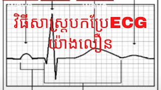 វិធីសាស្ត្របកប្រែECG យ៉ាងលឿន [upl. by Argus412]