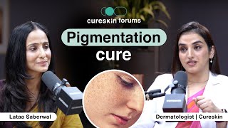 Pigmentation questions answered by Cureskin doctor  Cureskin forums with lataasaberwal [upl. by Ociredef329]