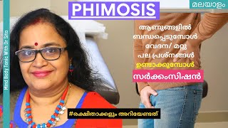 Phimosis  സർക്കംസിഷന്‍ ചേലാകര്‍മ്മംആണുങ്ങളില്‍ ബന്ധപ്പെടുമ്പോള്‍ വേദനമറ്റു പ്രശ്നങ്ങള്‍ Dr Sita [upl. by Giacobo]