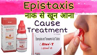 Naak se khoon aana  Nakseer ka gharelu ilaj  Nose bleeding in hindi  Epistaxis in hindi [upl. by Sakovich]