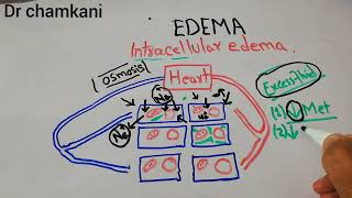 Renal system physiology 20  Edema  what are the Causes of intracellular edema  Medical Physiology [upl. by Eiuqnimod]