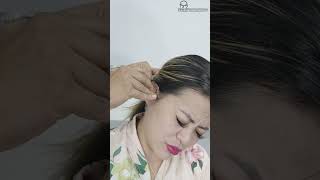 HOW TO PUT EAR DROPS THE RIGHT WAY [upl. by Ati]