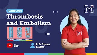 Thrombosis and Embolism with Dr Priyanka Sachdev [upl. by Aicekan]