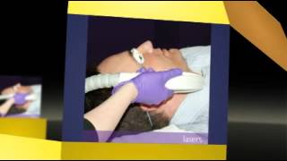 Syneron Laser Repair [upl. by Alexandros]