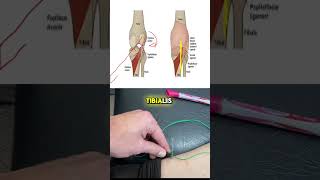 The Difference Between Tibialis Posterior amp Popliteus  Electroacupuncture [upl. by Nonnairb]