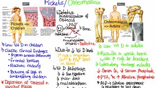 What is RicketsOsteomalacia [upl. by Ailliw393]