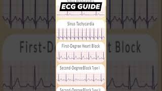 ECG Guide Biology new vedioviral vedioscience vedio heart check vedio [upl. by Hutchins]