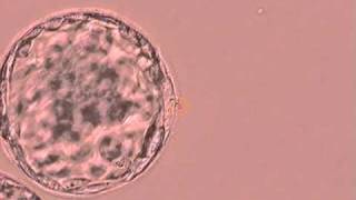 Human Blastocyst Artificial Collapse with Laser Fertility Specialists of Texasavi [upl. by Aciras730]