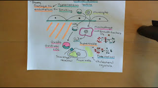 Cholesterol Metabolism Part 13 [upl. by Dayle787]